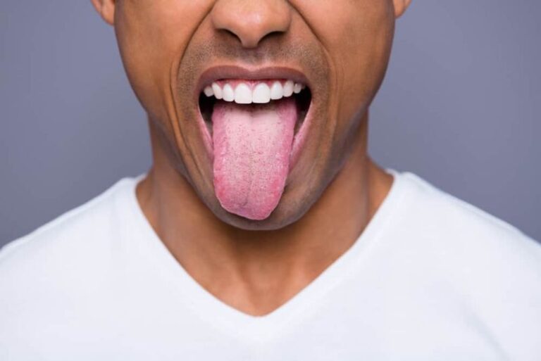 https: img.okezone.com content 2022 07 16 481 2630677 pria-3-kali-lebih-sering-terkena-kanker-lidah-dibanding-perempuan-IgANhnrXp1.jpg